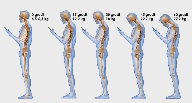 cellulare e male alle spalle